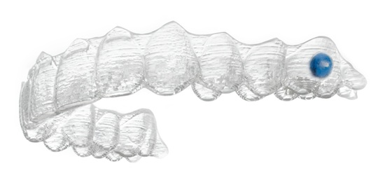 invisalign_dot